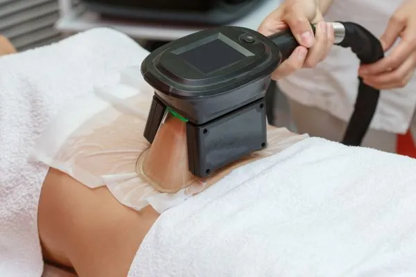 Image of person having fat freezing treatment to help weight gain Chapeltown