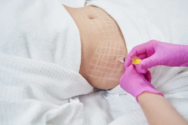 image of fat dissolving injections on love handles to help combat weight gain Chapeltown
